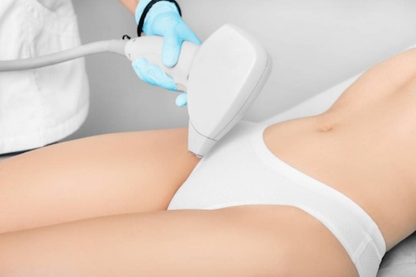 Triệt lông bikini tại spa với máy triệt lông bằng laser hiệu quả, an toàn