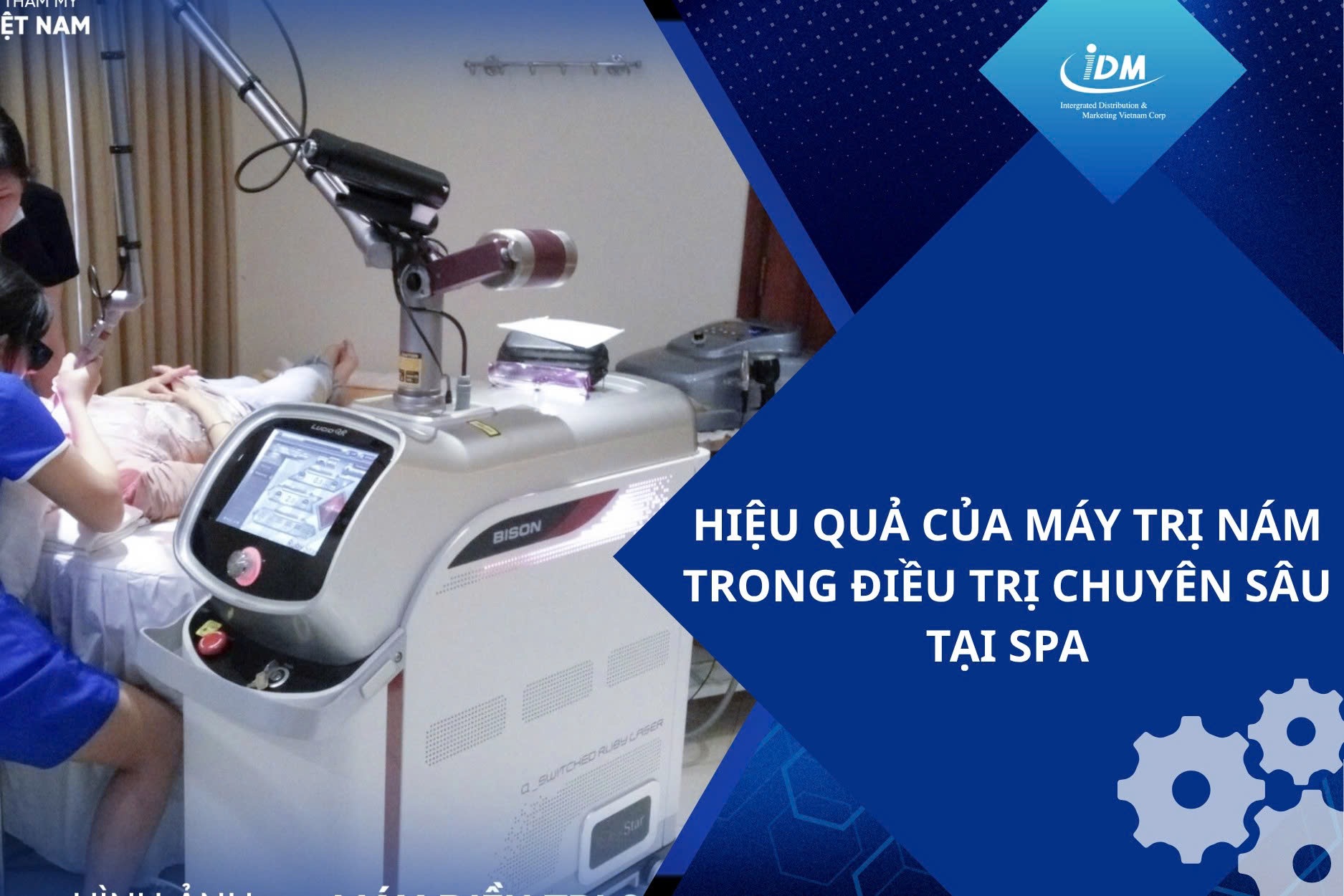Hiệu quả của máy trị nám trong điều trị chuyên sâu tại spa