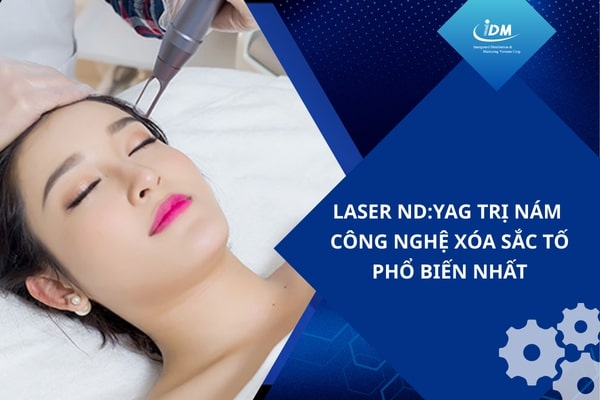 Laser ND:YAG trị nám – Công nghệ xóa sắc tố phổ biến nhất