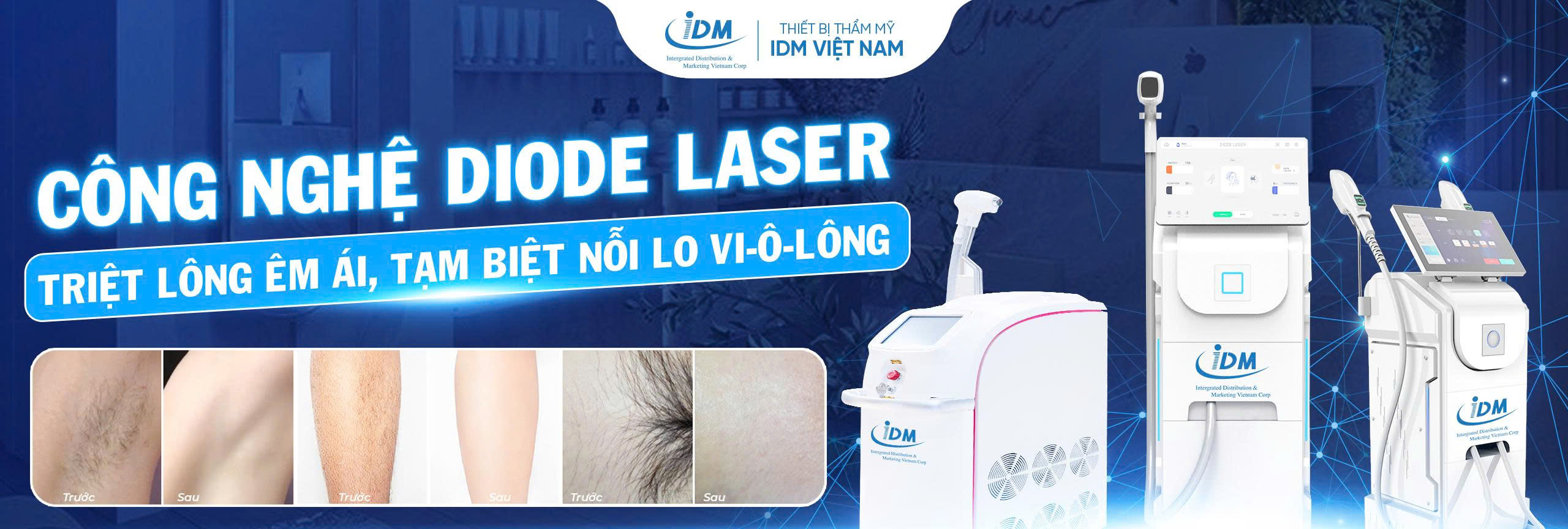Công nghệ Diode Laser