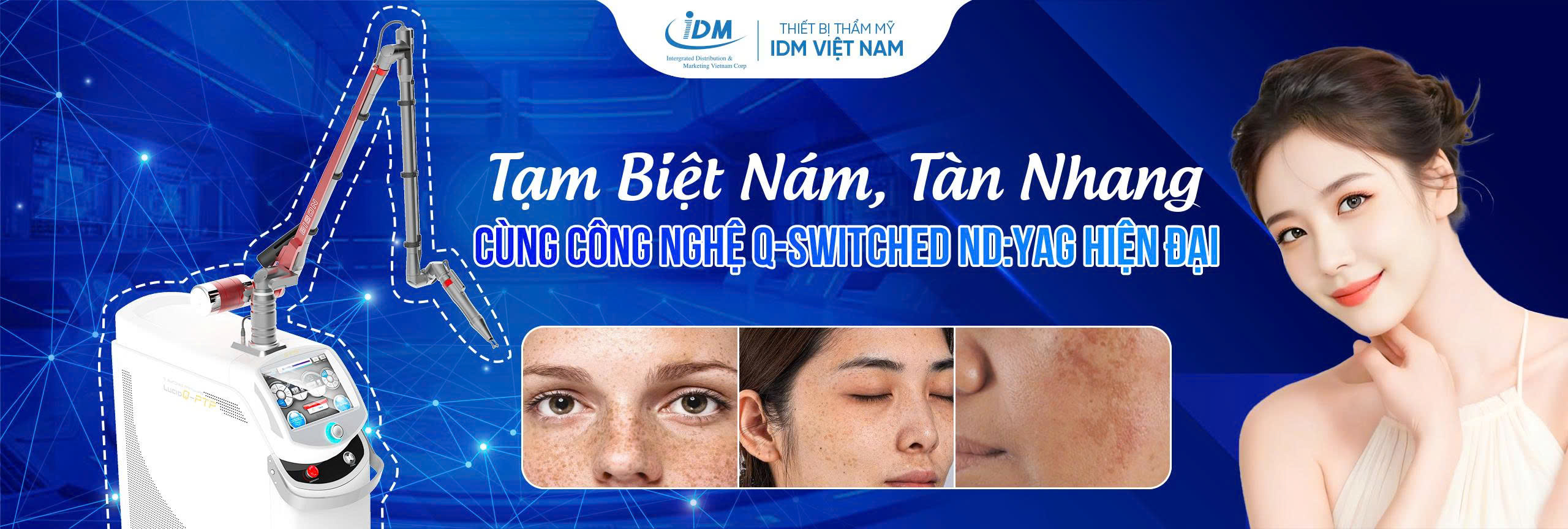 Q SWITCHED ND:YAG LASER