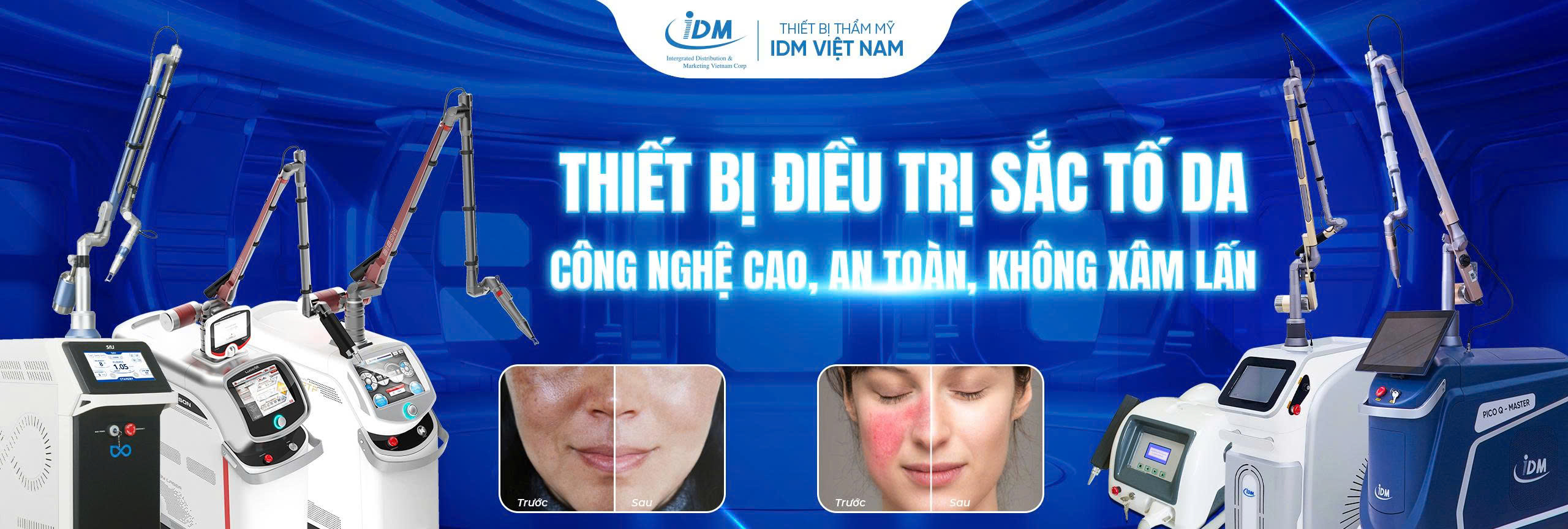 Máy điều trị sắc tố