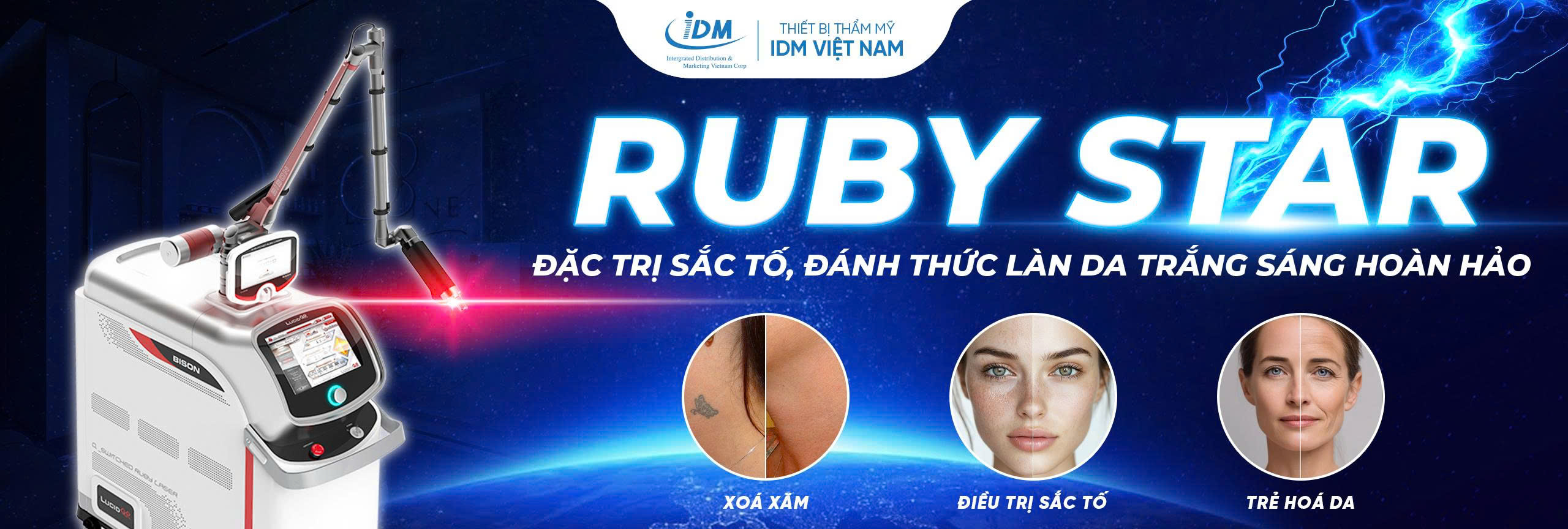 Q-Switched Ruby Laser