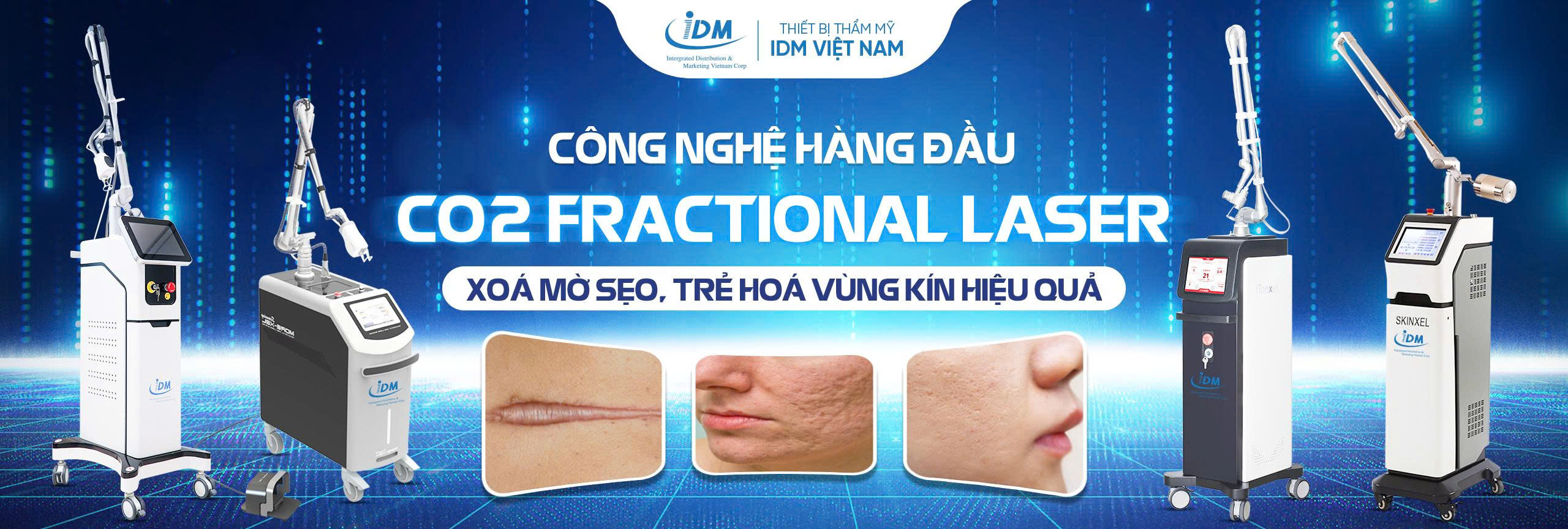 Công nghệ CO2 Fractional