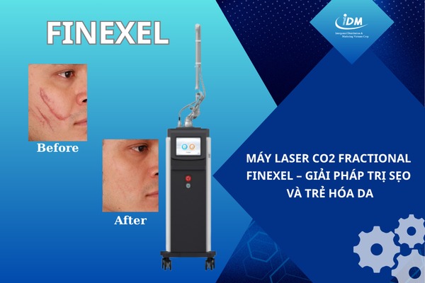 Máy laser CO2 Fractional Finexel – Giải pháp trị sẹo và trẻ hóa da