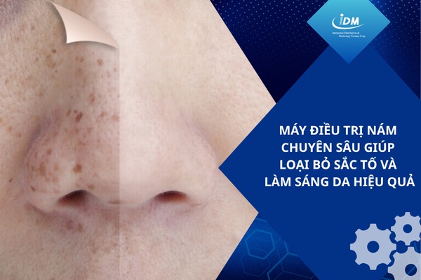 Máy điều trị nám chuyên sâu giúp loại bỏ sắc tố và làm sáng da hiệu quả