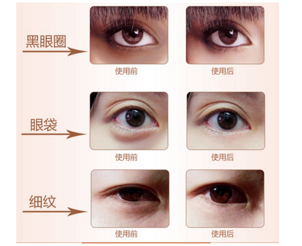 Máy chăm sóc da Golden Eyes mang lại hiệu quả rất cao, khách hàng sẽ thấy sự thay đổi rõ rệt sau mỗi lần trị liệu